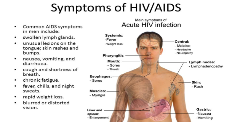 Aids 03